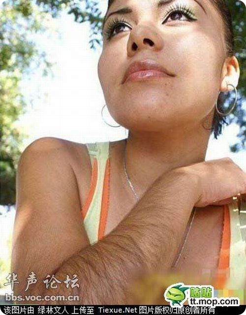 Волосатые руки девушек. Ужас. (5 фото)