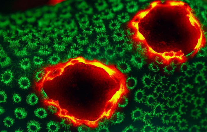 Nikon Small World 2011