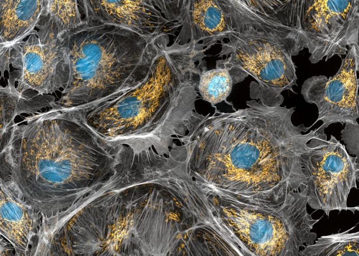 Nikon Small World 2011