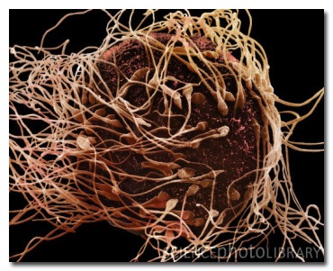 11 жутких чудовищ, которых без микроскопа не разглядеть