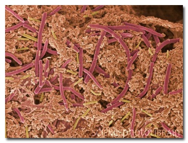 11 жутких чудовищ, которых без микроскопа не разглядеть